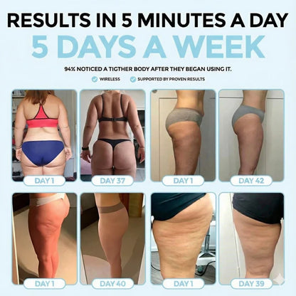 CircuSculpt™ Anti-Cellulite Massager